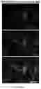 Fig. 18 - DUAL EXPRESSION VECTOR FOR GENE AUGMENTATION FOR CRUMBS COMPLEX HOMOLOGUE 1 (CRB1) MUTATIONS