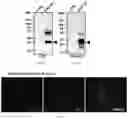 Fig. 19 - DUAL EXPRESSION VECTOR FOR GENE AUGMENTATION FOR CRUMBS COMPLEX HOMOLOGUE 1 (CRB1) MUTATIONS