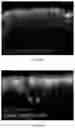 Fig. 24 - DUAL EXPRESSION VECTOR FOR GENE AUGMENTATION FOR CRUMBS COMPLEX HOMOLOGUE 1 (CRB1) MUTATIONS