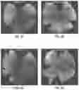 Fig. 08 - RAAV-GUANYLATE CYCLASE COMPOSITIONS AND METHODS FOR TREATING LEBER'S CONGENITAL AMAUROSIS-1 (LCA1)