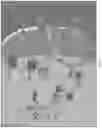 Fig. 09 - RAAV-GUANYLATE CYCLASE COMPOSITIONS AND METHODS FOR TREATING LEBER'S CONGENITAL AMAUROSIS-1 (LCA1)
