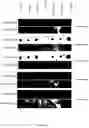 Fig. 11 - SYNTHESIS OF LONG-CHAIN POLYUNSATURATED FATTY ACIDS BY RECOMBINANT CELL