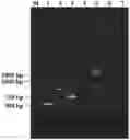 Fig. 01 - Xylose-induced genetically engineered bacteria used for producing ectoine and use thereof