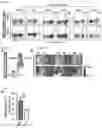 Fig. 11 - METHODS AND COMPOSITIONS FOR NONINVASIVE DETECTION OF ORGAN TRANSPLANT REJECTION