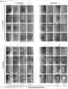 Fig. 16 - METHODS AND COMPOSITIONS FOR NONINVASIVE DETECTION OF ORGAN TRANSPLANT REJECTION