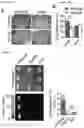 Fig. 17 - METHODS AND COMPOSITIONS FOR NONINVASIVE DETECTION OF ORGAN TRANSPLANT REJECTION