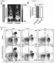 Fig. 19 - METHODS AND COMPOSITIONS FOR NONINVASIVE DETECTION OF ORGAN TRANSPLANT REJECTION
