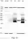 Fig. 14 - Sample preparation methods, systems and compositions