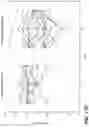 Fig. 21 - METHODS FOR DIAGNOSING AND TREATING INFLAMMATORY BOWEL DISEASE