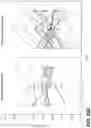 Fig. 24 - METHODS FOR DIAGNOSING AND TREATING INFLAMMATORY BOWEL DISEASE