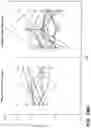 Fig. 41 - METHODS FOR DIAGNOSING AND TREATING INFLAMMATORY BOWEL DISEASE