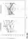 Fig. 62 - METHODS FOR DIAGNOSING AND TREATING INFLAMMATORY BOWEL DISEASE