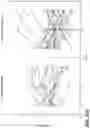 Fig. 68 - METHODS FOR DIAGNOSING AND TREATING INFLAMMATORY BOWEL DISEASE