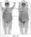 Fig. 25 - Methods for early detection of cancer