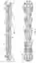 Fig. 04 - Split flow suction manifold