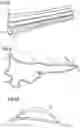 Fig. 04 - Method for creating a transition from an edge of an add-on part mounted on the outer surface of a rotor blade