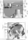 Fig. 08 - INTEGRATED PUMP ASSEMBLY WITH ONE MOVING PART WITH STACKED STATOR