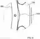 Fig. 07 - Vacuum pump, casing, and inlet port flange