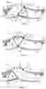 Fig. 08 - DEFLECTOR ASSEMBLY FOR OUTDOOR POWER EQUIPMENT