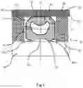 Fig. 02 - Packing structure for compression packing