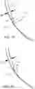 Fig. 09 - Circumferential rifling