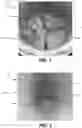 Fig. 02 - Phased array radar for fluid sensing