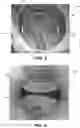Fig. 03 - Phased array radar for fluid sensing