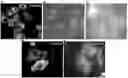 Fig. 01 - CONTRAST SOLUTION FOR THE CHARACTERISATION OF BIOLOGICAL SAMPLES BY ELECTRON OR CORRELATIVE MICROSCOPY