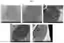 Fig. 04 - CONTRAST SOLUTION FOR THE CHARACTERISATION OF BIOLOGICAL SAMPLES BY ELECTRON OR CORRELATIVE MICROSCOPY
