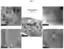 Fig. 05 - CONTRAST SOLUTION FOR THE CHARACTERISATION OF BIOLOGICAL SAMPLES BY ELECTRON OR CORRELATIVE MICROSCOPY