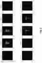 Fig. 07 - Particle emission tomography