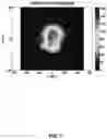 Fig. 09 - Particle emission tomography