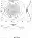 Fig. 19 - Particle emission tomography
