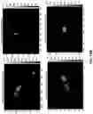 Fig. 24 - Particle emission tomography