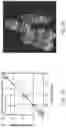 Fig. 16 - In situ measurement of absolute concentrations by normalized Raman imaging