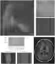 Fig. 01 - MATERIALS AND METHODS FOR DETECTING AND TREATING AUTOIMMUNE MOVEMENT DISORDERS