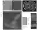 Fig. 02 - MATERIALS AND METHODS FOR DETECTING AND TREATING AUTOIMMUNE MOVEMENT DISORDERS