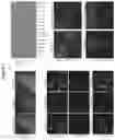Fig. 03 - MATERIALS AND METHODS FOR DETECTING AND TREATING AUTOIMMUNE MOVEMENT DISORDERS