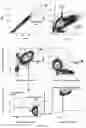 Fig. 29 - Method of evaluating progression of an infectious disease and/or inflammatory disease