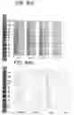 Fig. 05 - HUMAN METAPNEUMOVIRUS DETECTION REAGENT