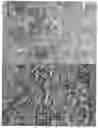 Fig. 01 - METHOD OF SELECTION FOR TREATMENT OF SUBJECTS AT RISK OF INVASIVE BREAST CANCER
