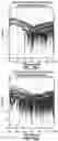 Fig. 25 - METHOD FOR SCREENING PERSONALIZED INTESTINAL ENVIRONMENT-IMPROVING MATERIAL AND COMPOSITION THEREFOR