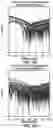 Fig. 26 - METHOD FOR SCREENING PERSONALIZED INTESTINAL ENVIRONMENT-IMPROVING MATERIAL AND COMPOSITION THEREFOR