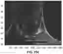 Fig. 28 - METHOD FOR SCREENING PERSONALIZED INTESTINAL ENVIRONMENT-IMPROVING MATERIAL AND COMPOSITION THEREFOR