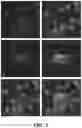 Fig. 02 - METHODS FOR THE DETECTION AND QUANTIFICATION OF CIRCULATING ENDOTHELIAL CELLS