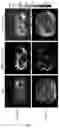 Fig. 06 - Vibration generating system for elastography equipment and control method thereof