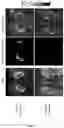 Fig. 07 - Vibration generating system for elastography equipment and control method thereof