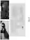 Fig. 12 - DIFFUSION DICTIONARY IMAGING (DDI) OF MICROSTRUCTURE AND INFLAMMATION