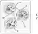 Fig. 21 - DIFFUSION DICTIONARY IMAGING (DDI) OF MICROSTRUCTURE AND INFLAMMATION