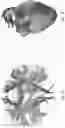 Fig. 22 - DIFFUSION DICTIONARY IMAGING (DDI) OF MICROSTRUCTURE AND INFLAMMATION